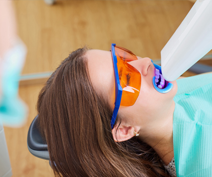 Cosmetic Family Dentistry Composite Dental vneers