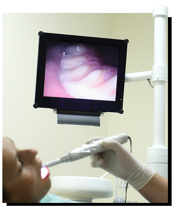 inter-oral-camera Family & Cosmetic Dentistry